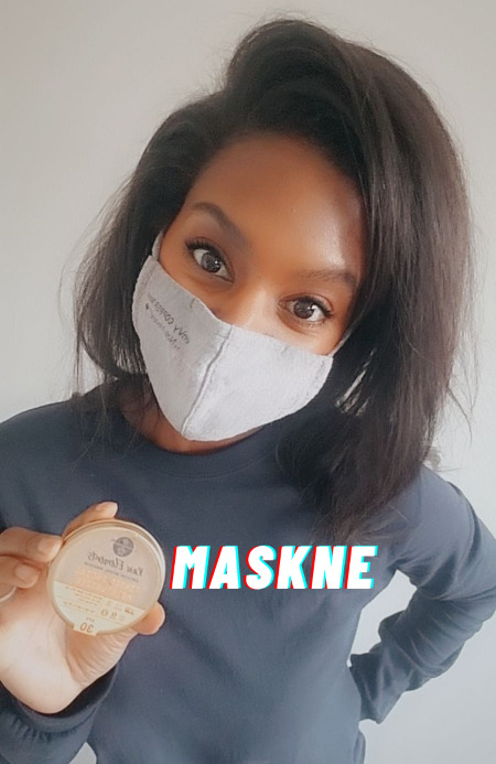 Maskne, Mask acne, Raw elements sunscreen, Maskne treatments, prevent maskne